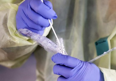Больничная касса подтвердила четыре случая ущерба здоровью из-за вакцины