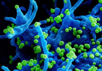 Lassa Virus