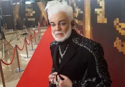 Киркоров в очередной раз ляжет под нож пластического хирурга